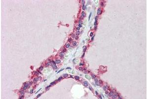 Human Thyroid (formalin-fixed, paraffin-embedded) stained with TRIM8 antibody ABIN462222 followed by biotinylated goat anti-rabbit IgG secondary antibody ABIN481713, alkaline phosphatase-streptavidin and chromogen. (TRIM8 抗体  (AA 36-85))