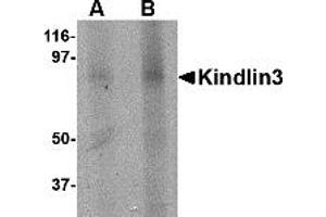 Western Blotting (WB) image for anti-Fermitin Family Member 3 (FERMT3) (C-Term) antibody (ABIN1030468) (FERMT3 抗体  (C-Term))