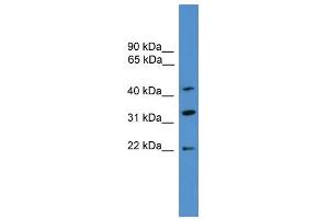 WB Suggested Anti-ARFIP1  Antibody Titration: 0. (ARFIP1 抗体  (C-Term))