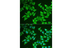 Immunofluorescence analysis of HeLa cells using ALAS2 antibody (ABIN5973907). (ALAS2 抗体)