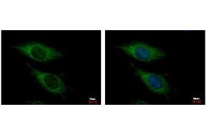 ICC/IF Image OGDH antibody [C2C3], C-term detects OGDH protein at Mitochondria by immunofluorescent analysis. (alpha KGDHC 抗体  (C-Term))