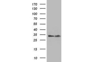 Western Blotting (WB) image for anti-Exosome Component 7 (EXOSC7) antibody (ABIN1498143) (EXOSC7 抗体)