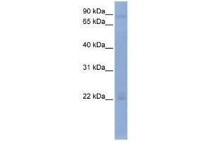 WB Suggested Anti-OAS2 Antibody Titration:  0. (OAS2 抗体  (Middle Region))