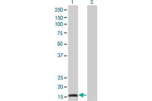 Western Blot analysis of IFNA2 expression in transfected 293T cell line by IFNA2 monoclonal antibody (M38), clone 2D10. (IFNA2 抗体  (AA 24-188))
