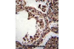 TUBA1C Antibody (C-term) immunohistochemistry analysis in formalin fixed and paraffin embedded human lung tissue followed by peroxidase conjugation of the secondary antibody and DAB staining. (TUBA1C 抗体  (C-Term))