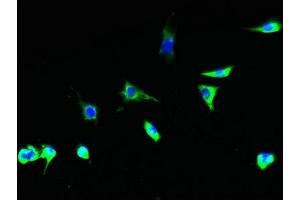 Immunofluorescent analysis of Hela cells using ABIN7153737 at dilution of 1:100 and Alexa Fluor 488-congugated AffiniPure Goat Anti-Rabbit IgG(H+L) (TSTA3 抗体  (AA 1-314))
