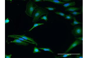 Immunofluorescence of purified MaxPab antibody to FXR2 on HeLa cell.