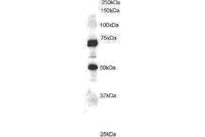 Western Blotting (WB) image for anti-Engulfment and Cell Motility 1 (ELMO1) (C-Term) antibody (ABIN2465646) (ELMO1 抗体  (C-Term))