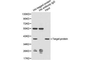 Image no. 1 for anti-His Tag antibody (ABIN2970882) (His Tag 抗体)