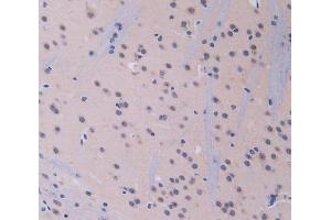 IHC-P analysis of brain tissue, with DAB staining. (IL12A 抗体  (AA 23-215))