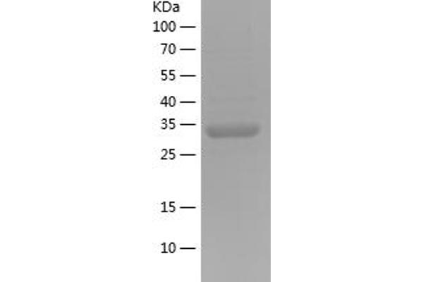 GLA Protein (AA 322-409) (His-IF2DI Tag)