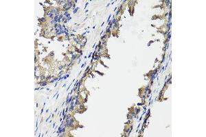 Immunohistochemistry of paraffin-embedded human prostate using OTC antibody (ABIN6003566) at dilution of 1/100 (40x lens). (OTC 抗体)