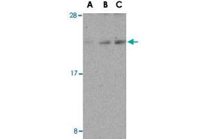 Western blot analysis of DAD1 in HepG2 cell lysate with DAD1 polyclonal antibody  at (A) 0. (DAD1 抗体  (C-Term))