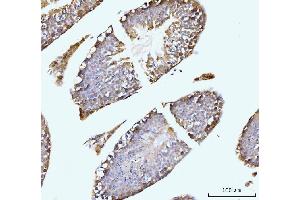 IHC analysis of GIT1 using anti-GIT1 antibody (ABIN7601683). (GIT1 抗体  (AA 415-736))