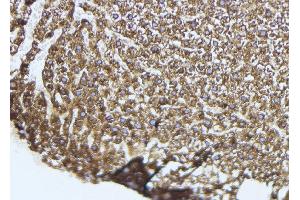 ABIN6274051 at 1/100 staining Mouse liver tissue by IHC-P. (TLR9 抗体  (Internal Region))