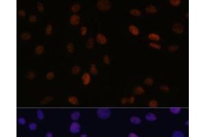 Immunofluorescence analysis of C6 cells using PSME3 Polyclonal Antibody at dilution of 1:100 (40x lens). (PSME3 抗体)