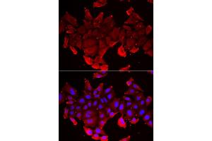 Immunofluorescence analysis of HeLa cell using SLC23A2 antibody. (SLC23A2 抗体)