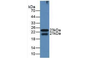 Western blot analysis of the recombinant protein. (LGALS8 抗体  (AA 151-316))