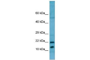 WB Suggested Anti-RPL11 AntibodyTitration: 1. (RPL11 抗体  (C-Term))