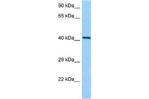 Host:  Mouse  Target Name:  EED  Sample Tissue:  Mouse Kidney  Antibody Dilution:  1ug/ml (EED 抗体  (N-Term))