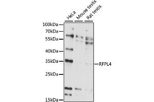 Western blot analysis of extracts of various cell lines, using RFPL4 antibody (ABIN7269924) at 1:1000 dilution. (RFPL4A 抗体  (AA 1-100))
