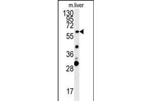 ZCCHC5 Antibody (N-term) (ABIN654002 and ABIN2843937) western blot analysis in mouse liver tissue lysates (15 μg/lane). (ZCCHC5 抗体  (N-Term))