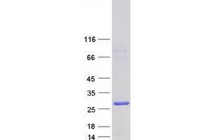 Validation with Western Blot