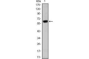 Western blot analysis using OTX2 mAb against human OTX2 (AA: 40-297) recombinant protein. (OTX2 抗体)