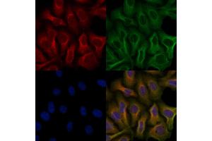 ABIN6259007 and ABIN6276161 staining Hela cells by IF/ICC.