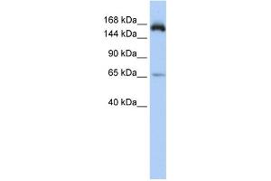 WB Suggested Anti-KIAA0460 Antibody Titration: 0. (RPRD2 抗体  (Middle Region))