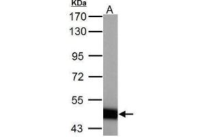 WB Image ABAT antibody detects ABAT protein by Western blot analysis. (ABAT 抗体  (C-Term))