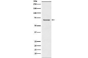 Western blot analysis of GABA A Receptor beta 2 expression in A549 cell lysate.