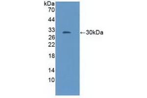 Detection of Recombinant NOS1AP, Mouse using Polyclonal Antibody to Nitric Oxide Synthase 1 Adaptor Protein (NOS1AP) (NOS1AP 抗体  (AA 19-251))