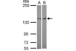 WB Image Sample (30 ug of whole cell lysate) A: A549 B: HCT116 5% SDS PAGE antibody diluted at 1:1000 (PTPN14 抗体  (C-Term))