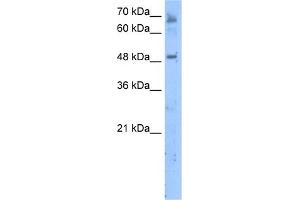 WB Suggested Anti-LENG4 Antibody Titration:  5. (MBOAT7 抗体  (C-Term))
