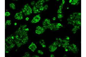 Image no. 1 for anti-Aconitase 2, Mitochondrial (ACO2) antibody (ABIN1496412) (ACO2 抗体)