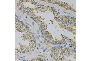 Immunohistochemistry of paraffin-embedded human prostate using EIF4B Antibody. (EIF4B 抗体)