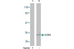 Western blot analysis of extracts from A2780 cells using CDK2 polyclonal antibody  . (CDK2 抗体)