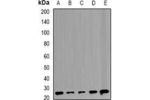 Western blot analysis of TMP21 expression in Raji (A), Hela (B), MCF7 (C), mouse liver (D), rat lung (E) whole cell lysates. (TMED10 抗体)