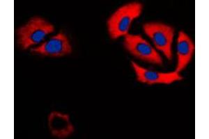 Immunofluorescent analysis of Carbonic Anhydrase 6 staining in H9C2 cells. (CA6 抗体  (C-Term))