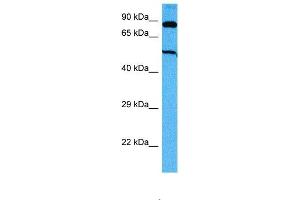Host:  Mouse  Target Name:  SUFU  Sample Tissue:  Mouse Skeletal Muscle  Antibody Dilution:  1ug/ml (SUFUH 抗体  (Middle Region))