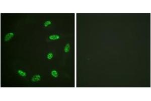 Immunofluorescence analysis of HeLa cells, using ERF (Ab-526) Antibody. (ERF 抗体  (AA 492-541))