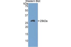 Western blot analysis of the recombinant protein. (TNNT1 抗体  (AA 1-228))