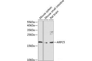 Western blot analysis of extracts of various cell lines using ARPC5 Polyclonal Antibody at dilution of 1:1000. (ARPC5 抗体)