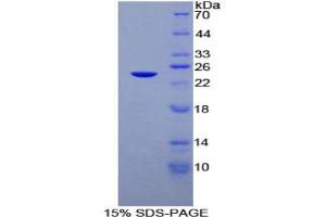 SDS-PAGE analysis of Rat DISC1 Protein. (DISC1 蛋白)