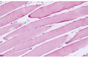 Human Skeletal Muscle: Formalin-Fixed, Paraffin-Embedded (FFPE) (MSH3 抗体  (AA 51-100))