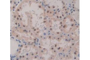 Used in DAB staining on fromalin fixed paraffin- embedded Kidney tissue (POLA1 抗体  (AA 1240-1462))