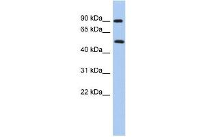 PRMT7 antibody used at 1 ug/ml to detect target protein. (PRMT7 抗体  (N-Term))