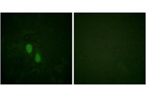 Immunofluorescence analysis of HeLa cells, using hnRPD Antibody . (HNRNPD/AUF1 抗体)