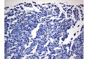Image no. 1 for anti-Zinc Finger E-Box Binding Homeobox 2 (ZEB2) (AA 1-350) antibody (ABIN1490760) (ZEB2 抗体  (AA 1-350))